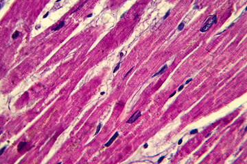Cardiac hypertrophy. Cardiac muscle fibers in longitudinal section, showing elongated nuclei and clear striations. High-resolution histology image