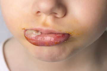 Close-up of a child's face with food stains around the lips, capturing a playful and candid childhood moment with vibrant detail.