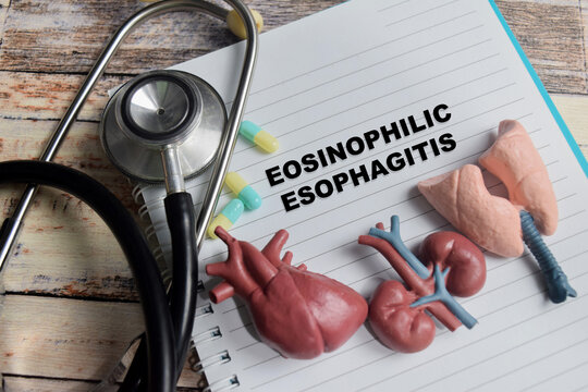 Concept of eosinophilic esophagitis write on book isolated on Wooden Table.