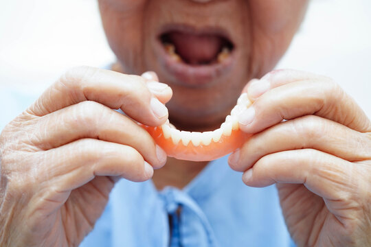 Asian senior woman patient holding teeth denture in her hand for chew food.