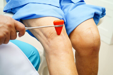 Asian doctor knock on knee reflex nerve for check and treatment senior patient in hospital.