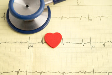 Stethoscope on electrocardiogram ECG, heart wave, heart attack, cardiogram report.