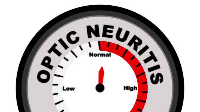 Optic Neuritis text or word shown with a barometer or tachometer-style gauge, representing varying levels of vision impairment and inflammation severity of the optic nerve