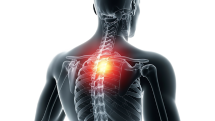 Human spine x-ray view showing neck and upper back pain inflammation concept isolated on transparent background
