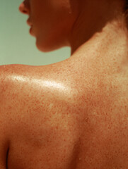 Fototapeta premium Close up of freckles (ephelides), health, skin care category. UV exposure, sun sensitivity, UV Damage. 