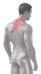 Human body diagram highlighting sciatica pain path spine healthcare illustration educational mood clinical tone straight view, Realistic Photo