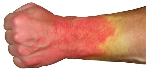 Human body diagram highlighting wrist and forearm pain office health healthcare concept professional calm mood instructional tone straight view, Realistic Photo