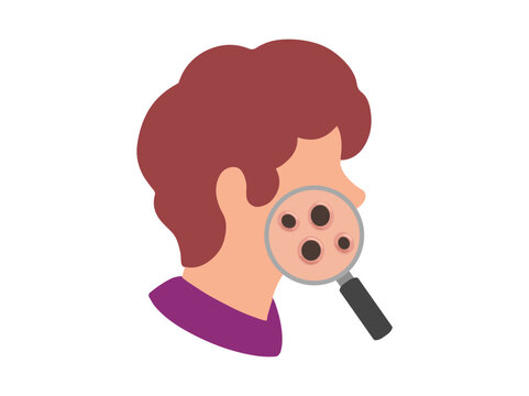 Acne Blackhead in Face Skin Illustration
