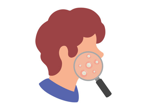 Hand Drawn Acne Whitehead in Face Skin Clip Art
