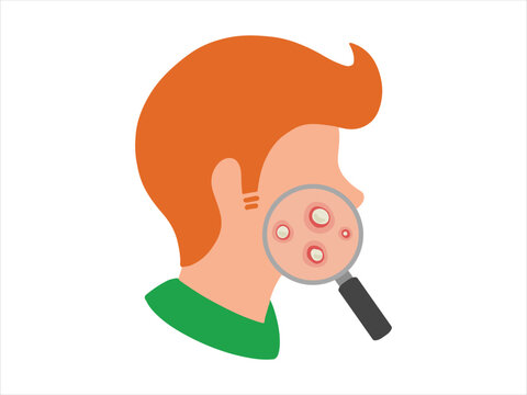 Hand Drawn Acne Pustule in Face Skin Clip Art

