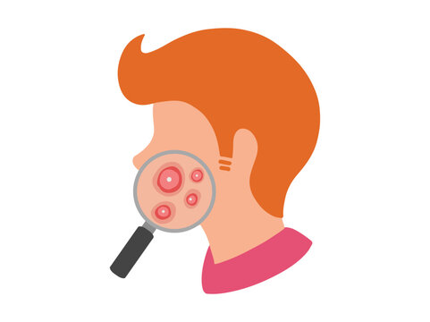 Acne Cystic in Face Skin Clip Art
