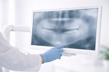 Dental Professional Analyzing an X-Ray Image on a Monitor, Highlighting Oral Health and Treatment Options in a Modern Clinic Environment