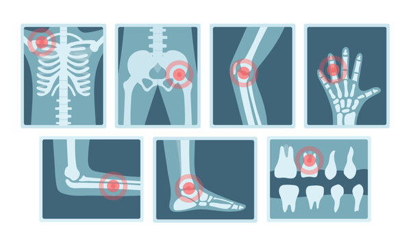 A set of X-ray images of various parts of the human body with a red dot on a white background. Diagnosis of bone problems. Elements of medicine.