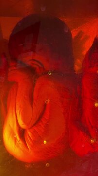 Formalin Preserved Late Term Fetal Specimen for Medical Research