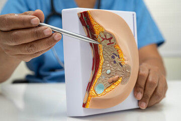 doctor holding female breast human anatomy model.