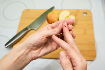A close-up of hands examining a cut finger with a drop of blood near a cutting board with an apple...