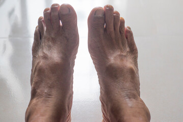Close up of the feet of a senior woman on a white background