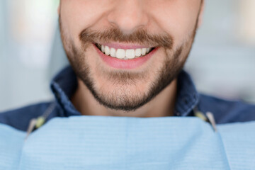 Closeup of man dental clinic patient white healthy smile, unrecognizable bearded man with napkin on his chest showing his beautiful smile, showing result of treatment at modern dentistry, cropped
