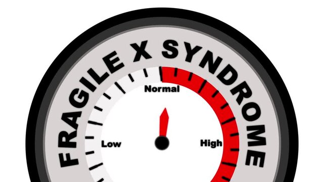 Fragile X Syndrome text or word shown with a barometer or tachometer-style gauge, representing varying levels of intellectual disability and behavioral symptoms associated with the genetic disorder
