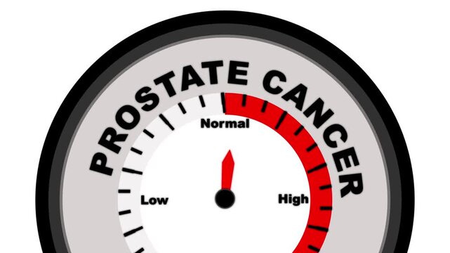 Prostate Cancer text or word shown with a barometer or tachometer-style gauge, representing varying levels of disease progression and severity in the prostate