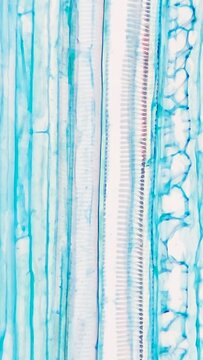 Longitudinal section of plant stem showing spiral and sclariform xylem vessels