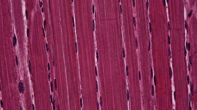 Microscopic view of skeletal muscle tissue showing elongated fibers and nuclei in longitudinal section, stained pink and purple.