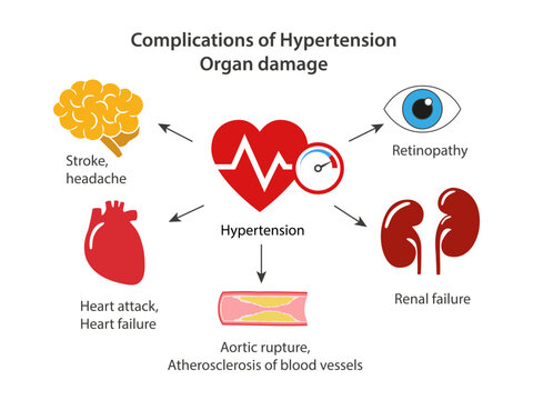 Complications of hypertension. Organ damage. Medical illustration showing target organs and possible diseases. Flat style vector illustration isolated on a white background.