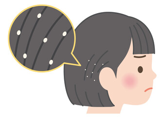 髪にアタマジラミの卵が付着している子供