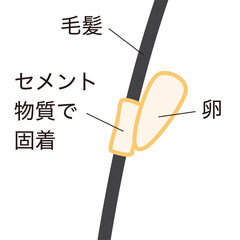 アタマジラミの卵