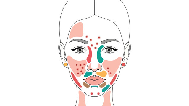 Face mapping skin analysis diagram