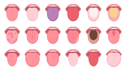 舌の状態のイラスト素材セット