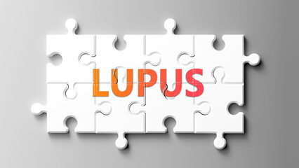 Lupus complex like a puzzle - pictured as word lupus on a puzzle pieces to show that lupus is complex and needs cooperating pieces that fit together. ,3d illustration