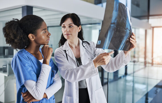 Doctor, nurse and xray with thinking in clinic for injury solution, surgery planning or analysis. Women, medical team and discussion with knee scan for joint dislocation, problem solving and decision - Powered by Adobe