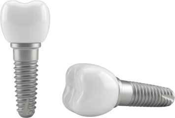 Two realistic white dental implants with metallic screw bases one standing upright the other lying horizontally displaying detailed threads and porcelain crowns tooth implant transparent background