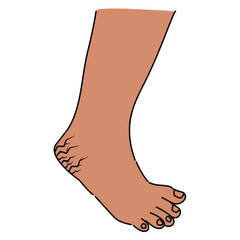 Cracks and fissures on the heels due to skin that is too dry or too moist.