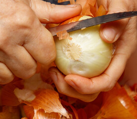 A person is cutting an onion with a knife