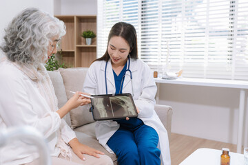 Knee model showing the process of osteoarthritis and knee arthroplasty, doctors explaining symptoms and treatment to patients.