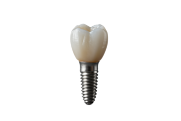 Single Dental Implant with Ceramic Crown