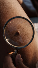 Close-up of skin with magnifying glass showing detailed skin texture and pores.