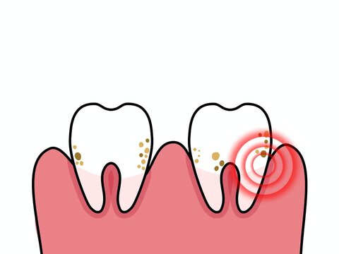 Cartoon vector illustration of dental health concept, dirty and sensitive tooths