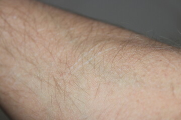 Fototapeta premium Close view of a human arm showing skin texture and hair detail during indoor lighting around midday