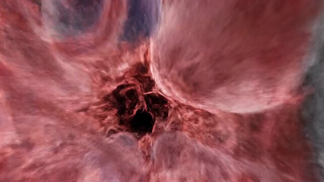 Professional 3D Visualization of a Brain Arteriovenous Malformation