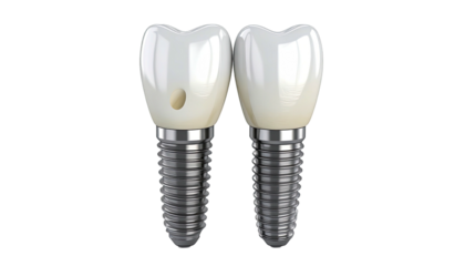Computer-generated illustration of two dental implants, one with a cavity