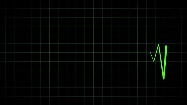 Green cardiograph recording animation showing heartbeat flatline in 4K video quality, ideal for medical monitoring visuals, emergency concepts, and healthcare video backgrounds.