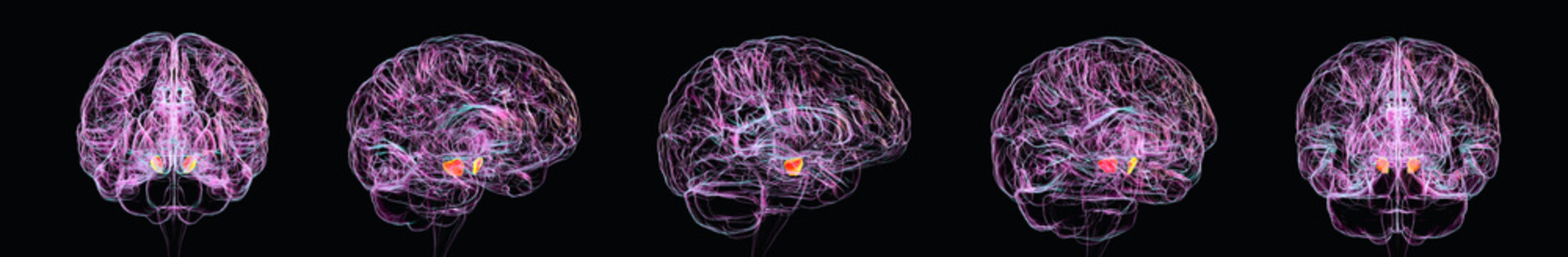 Substantia nigra, 3D illustration showing the human brain in multiple views with the substantia nigra highlighted to demonstrate its midbrain location and role in motor control.