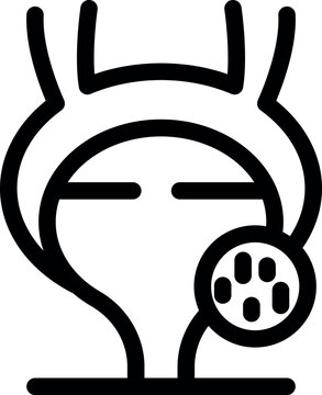 Bladder stones causing pain and discomfort, a common urological issue requiring medical attention