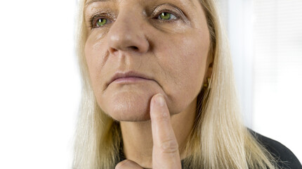 Wrinkled Mature woman before face lift surgery.