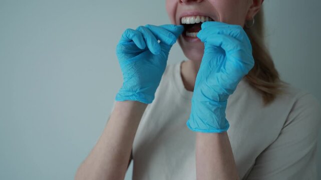 Woman wearing medical gloves putting on clear dental aligners. Close-up view of orthodontic treatment process, teeth straightening, and modern dental care. Oral health, dentistry, and healthcare conce