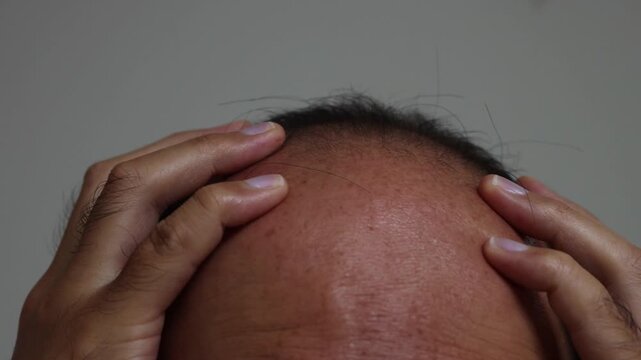 薄毛の頭を押さえて絶望する男性の頭（日本人、30代、顔無し）