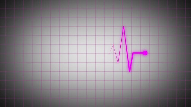Neon pink medical waveform on grey grid background illustrating healthcare monitoring, cardiology data display, digital medical technology, and abstract clinical visualization.